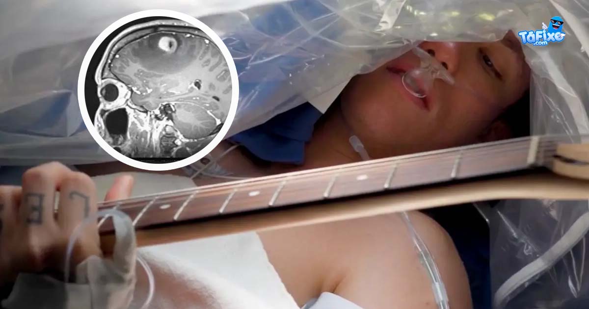 Paciente com tumor no cérebro toca guitarra durante cirurgia